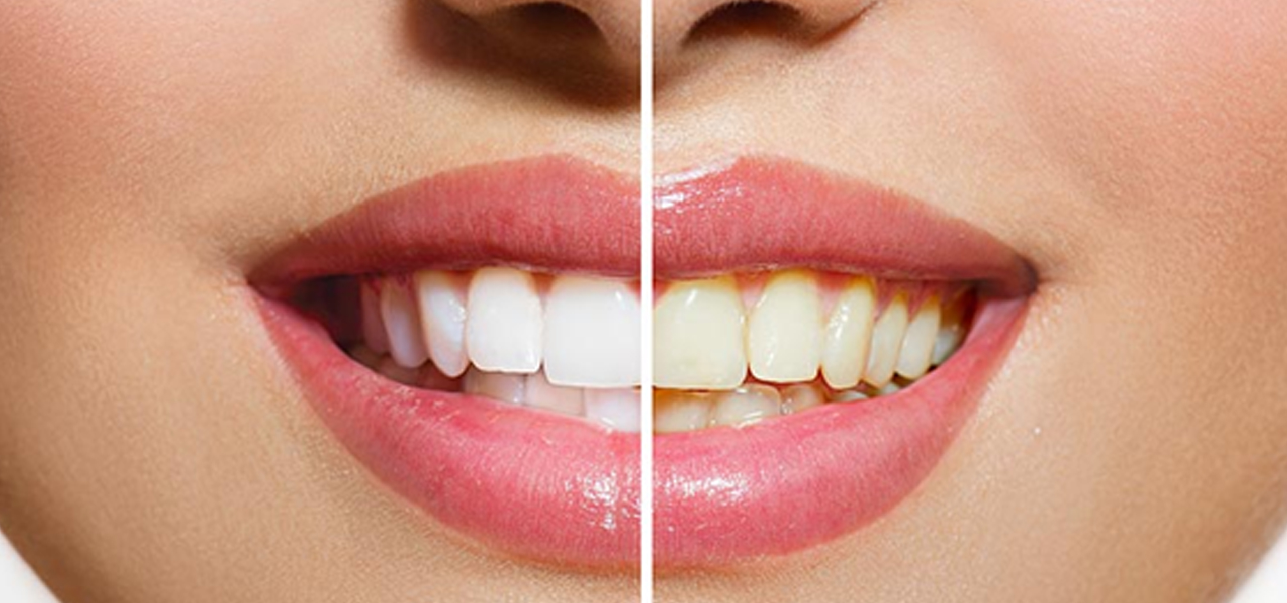 dental hospital in ameerpet 