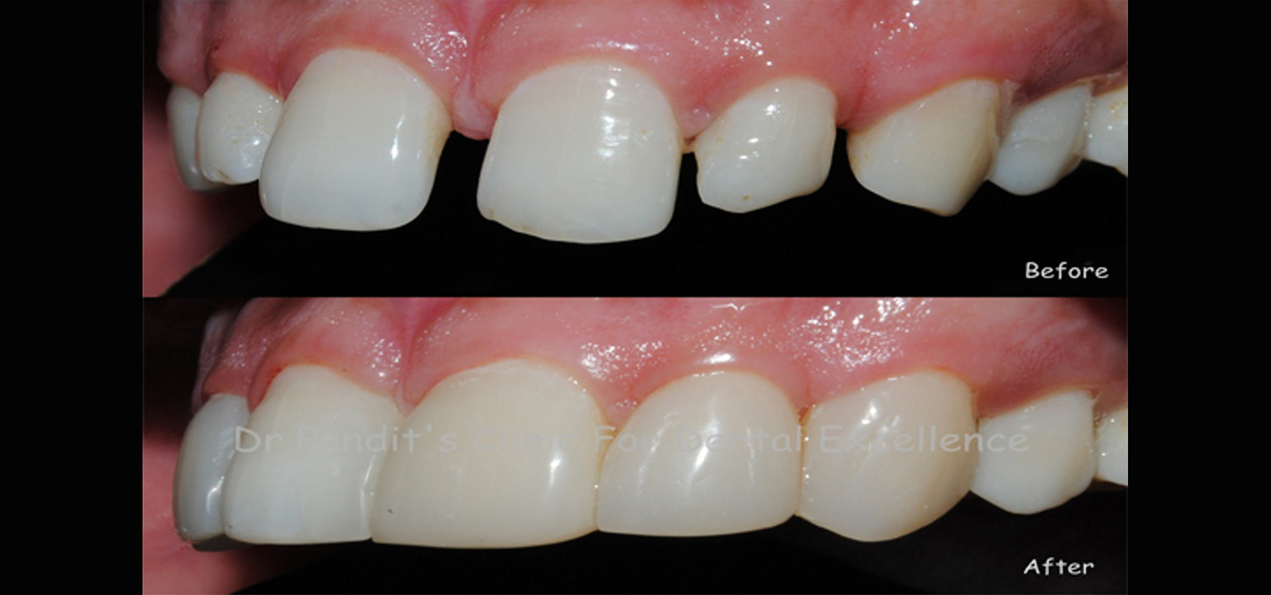 best dental clinic in hyderabad 
