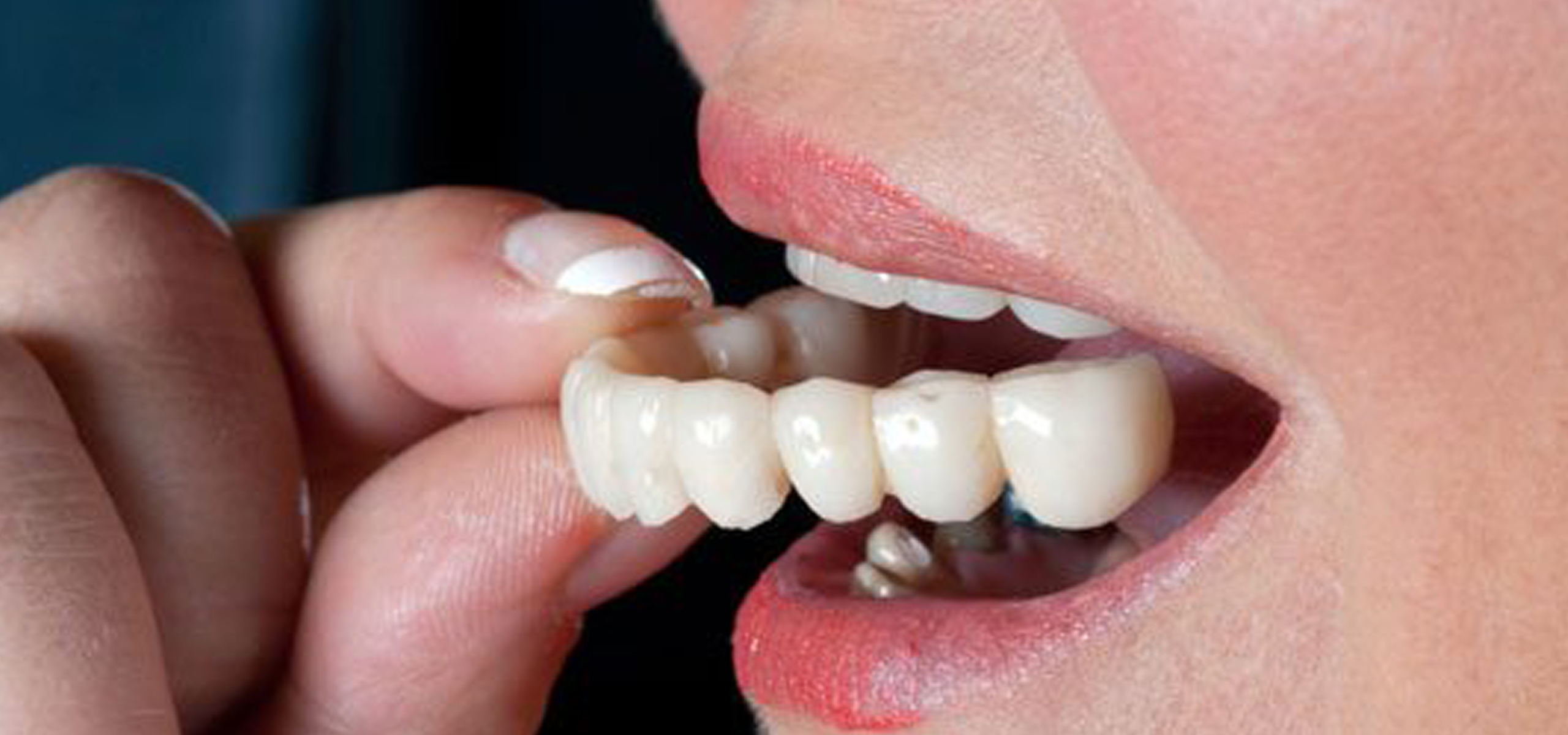 best dental doctors in hyderabad 
