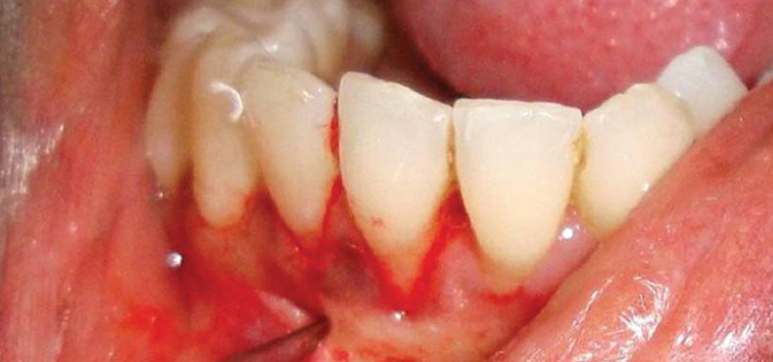 best dental surgeon in hyderabad 
