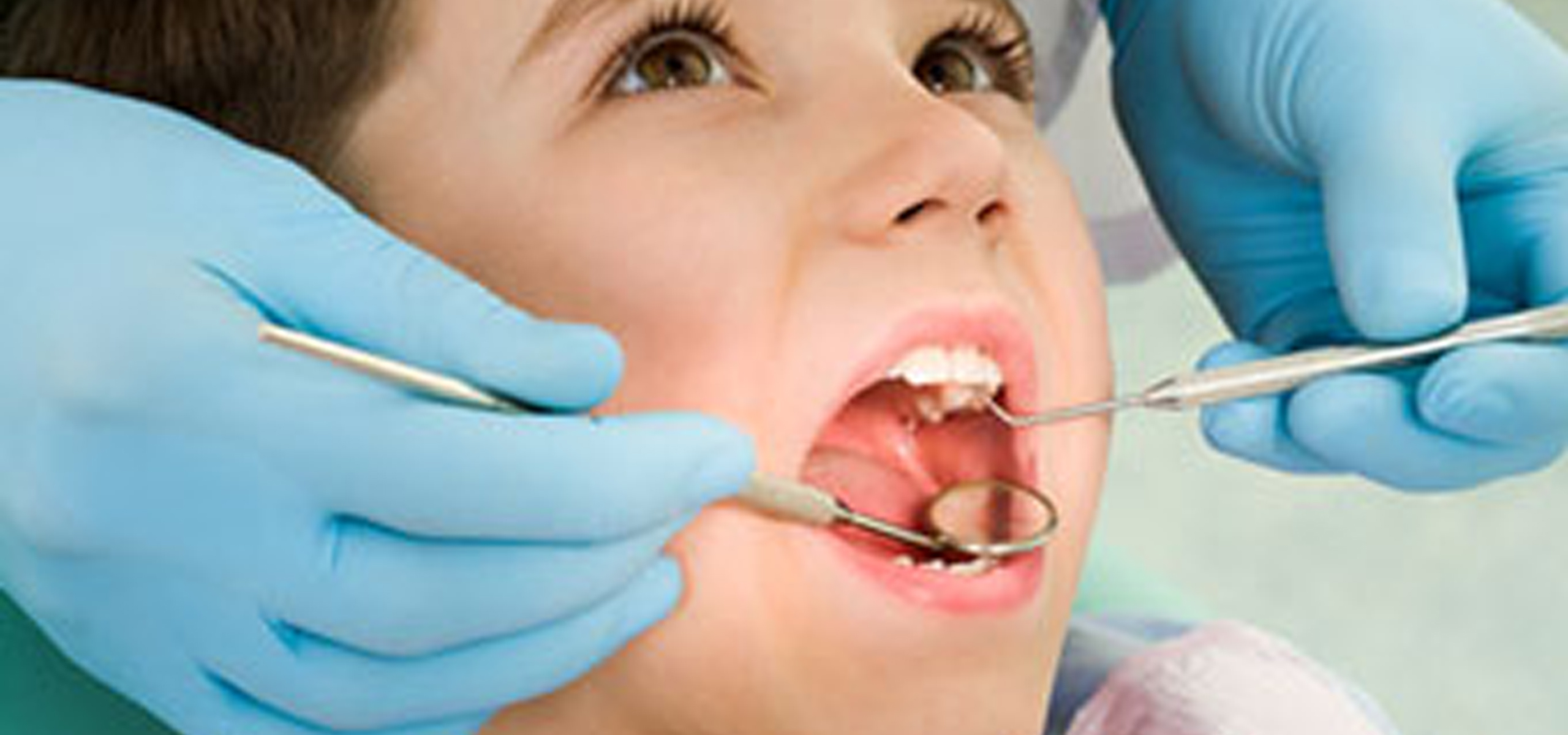 best pediatric dentist in hyderabad 
