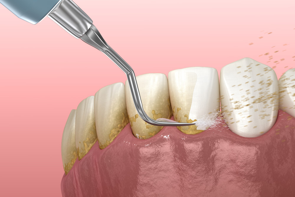  dental specialist in hyderabad 
