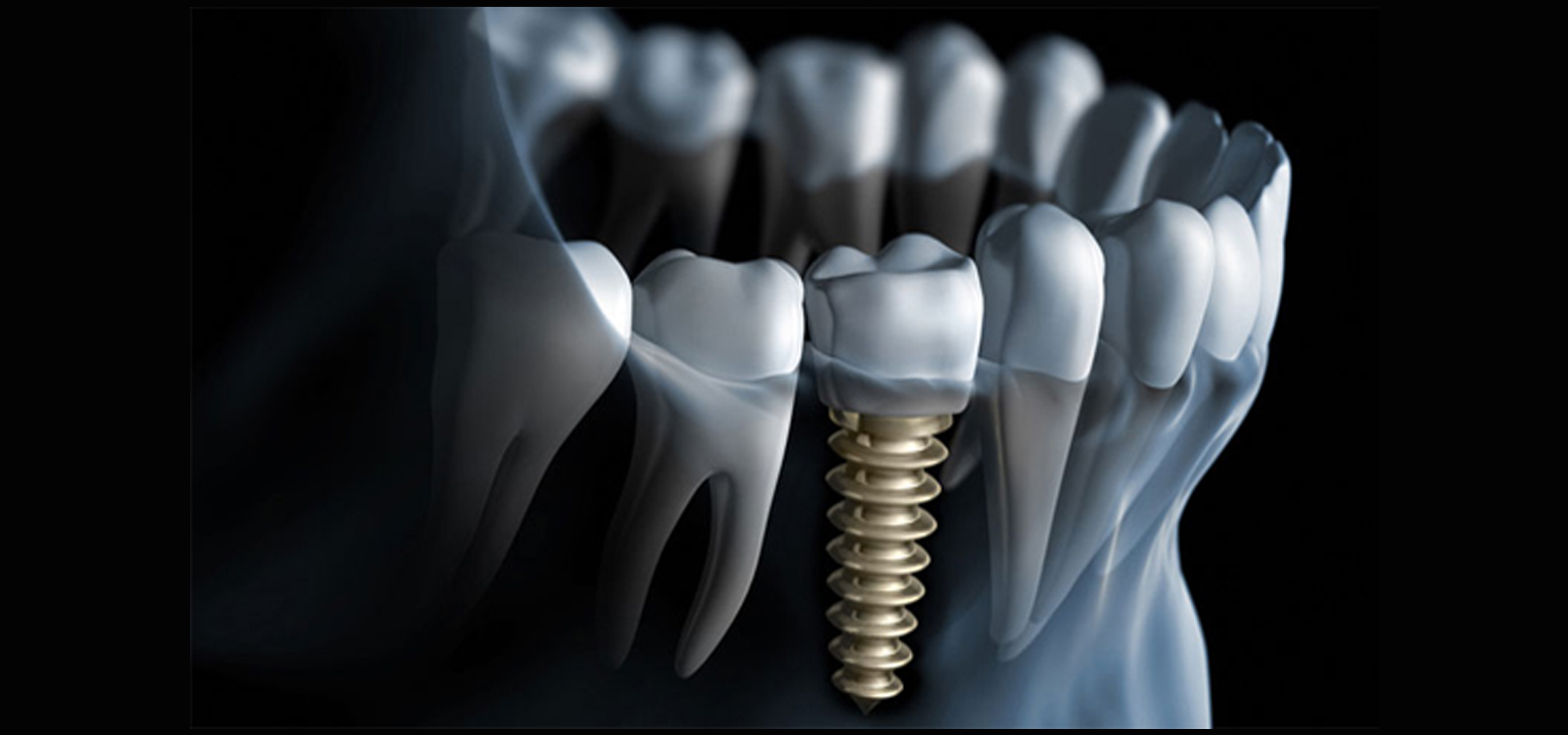 dental treatment in hyderabad 
